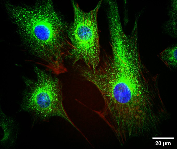 BPAE cells2-100X-SpinDisk-405&488&525